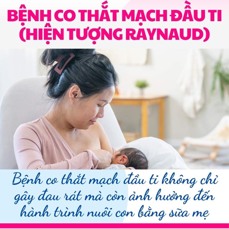 bệnh co thắt đầu ti khi cho con bú